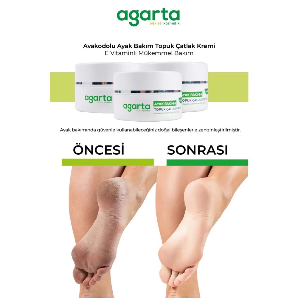 Agarta Ayak ve Topuk Çatlak Bakım Kremi 100ML (3 Lü Set)